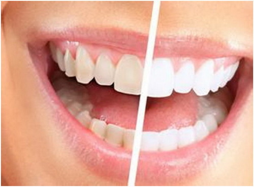 拔智齿的可吸收线多久能被吸收(拔智齿用的可吸收线多久能吸收)